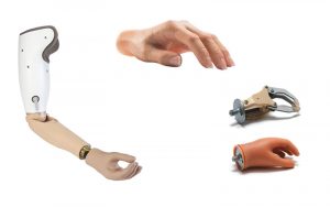 پروتز اندام فوقانی