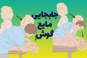 فیزیوتراپی عصب گوش